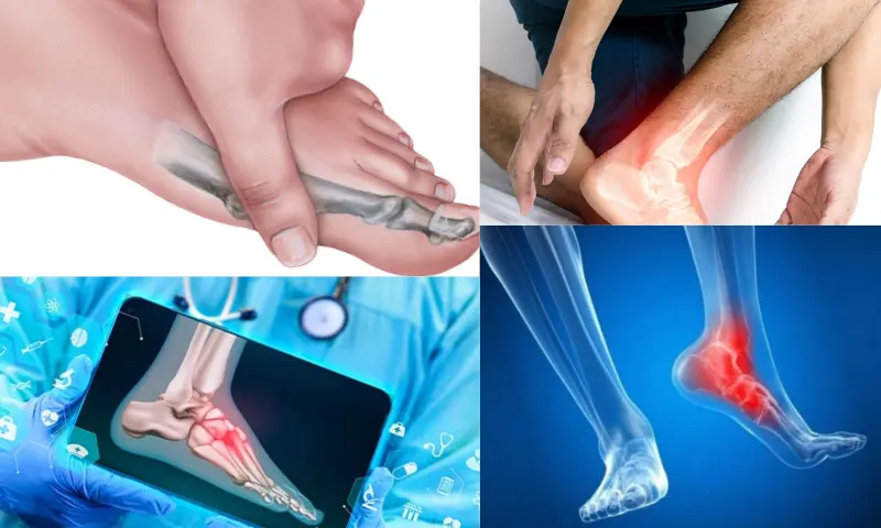 Ayak Cerrahisi Nedir?