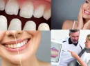 Türkiye'de Diş Tasarımı - تصميم الاسنان في تركيا Nerede Yaptırılır?