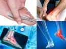 Ayak Cerrahisi Nedir?