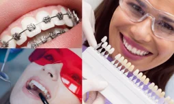 Düzce Diş Teli Fiyatları ve Uzman Hekim Kontrolü