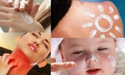 Güneş Alerjisi Nedir ve Nasıl Oluşur?