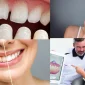 Türkiye'de Diş Tasarımı - تصميم الاسنان في تركيا Nerede Yaptırılır?