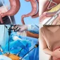 Gastrik Sleeve ile Tüp Mide Ameliyatı Arasındaki Farklar Nelerdir?
